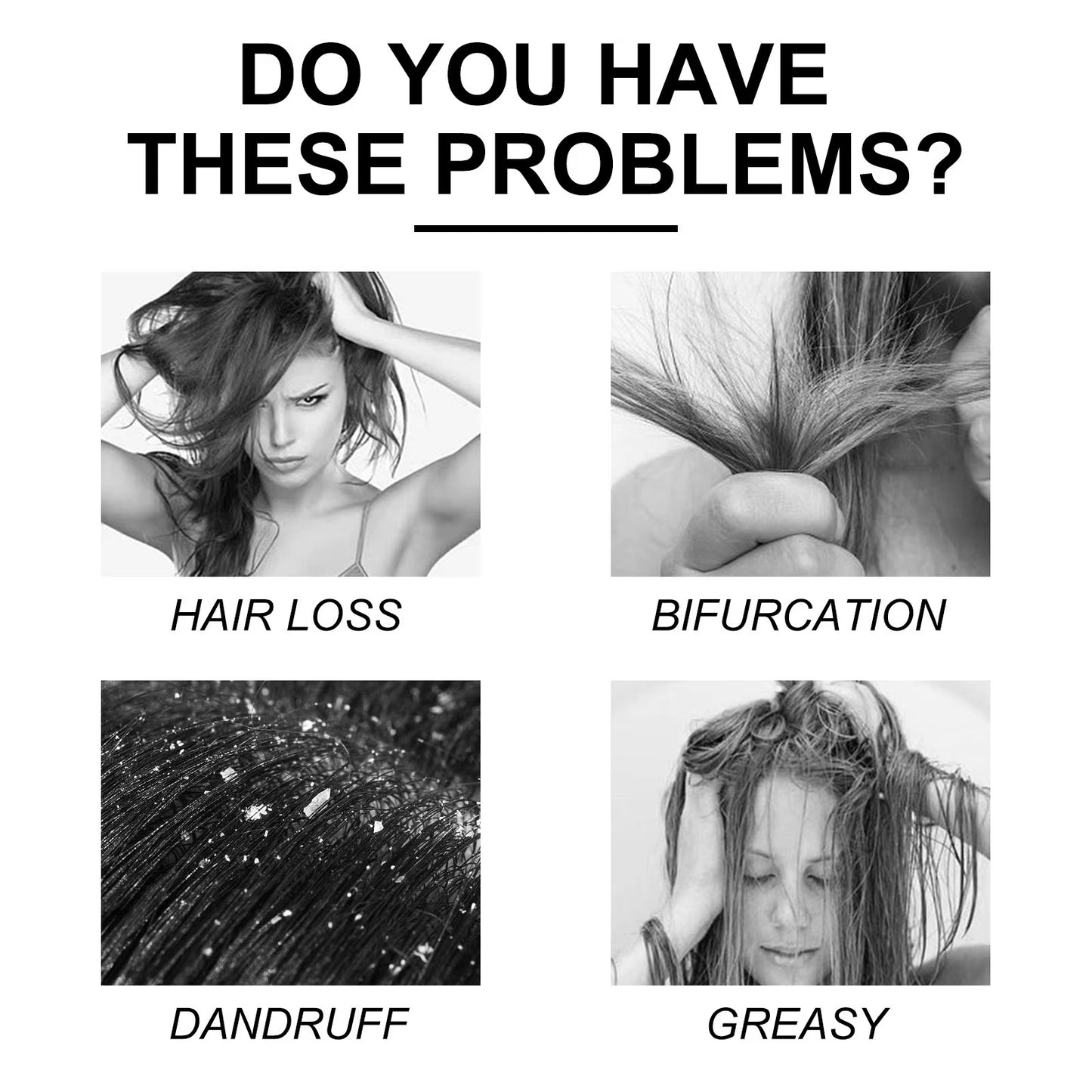 Shampoo limpiador del cuero cabelludo anticaída, alivia la picazón, elimina la caspa, controla la grasa y repara para favorecer el crecimiento del cabello.